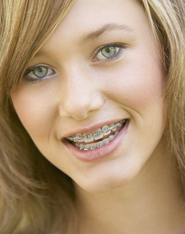 smiling girl with braces